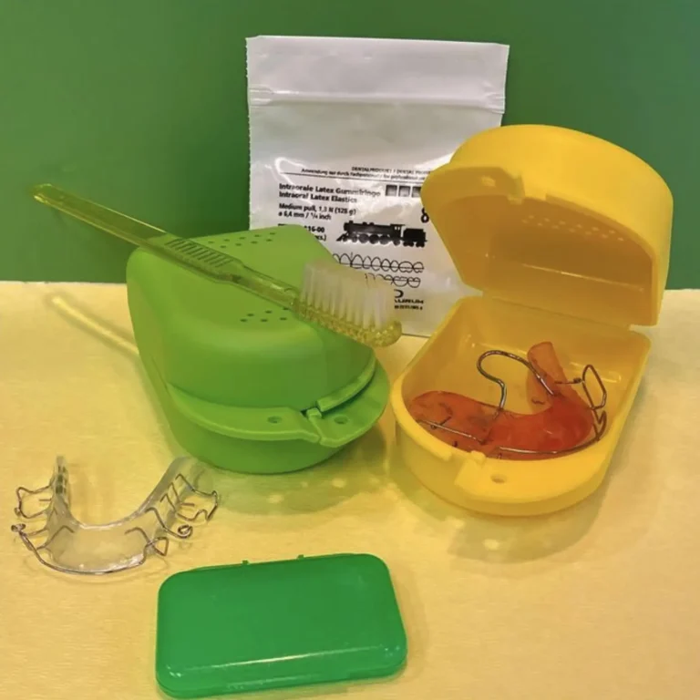 Zahnspangentipps KFO Hannover